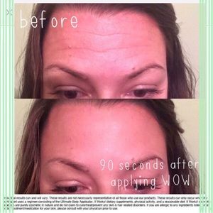 wrinkle cream that works in 90 seconds